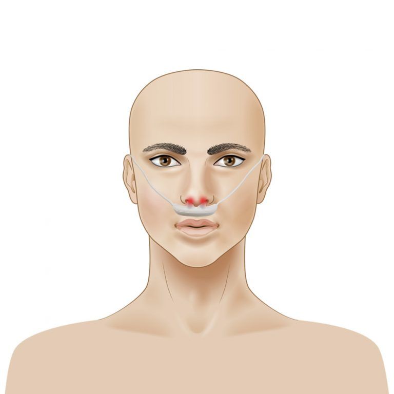 eff2ef38c51ebda356bb439593fd6057.MiraMate-Cold-Laser-Wrist-X8-768x768